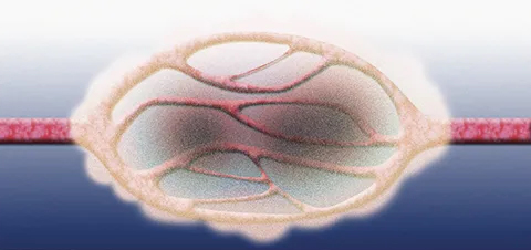 がん組織加熱図